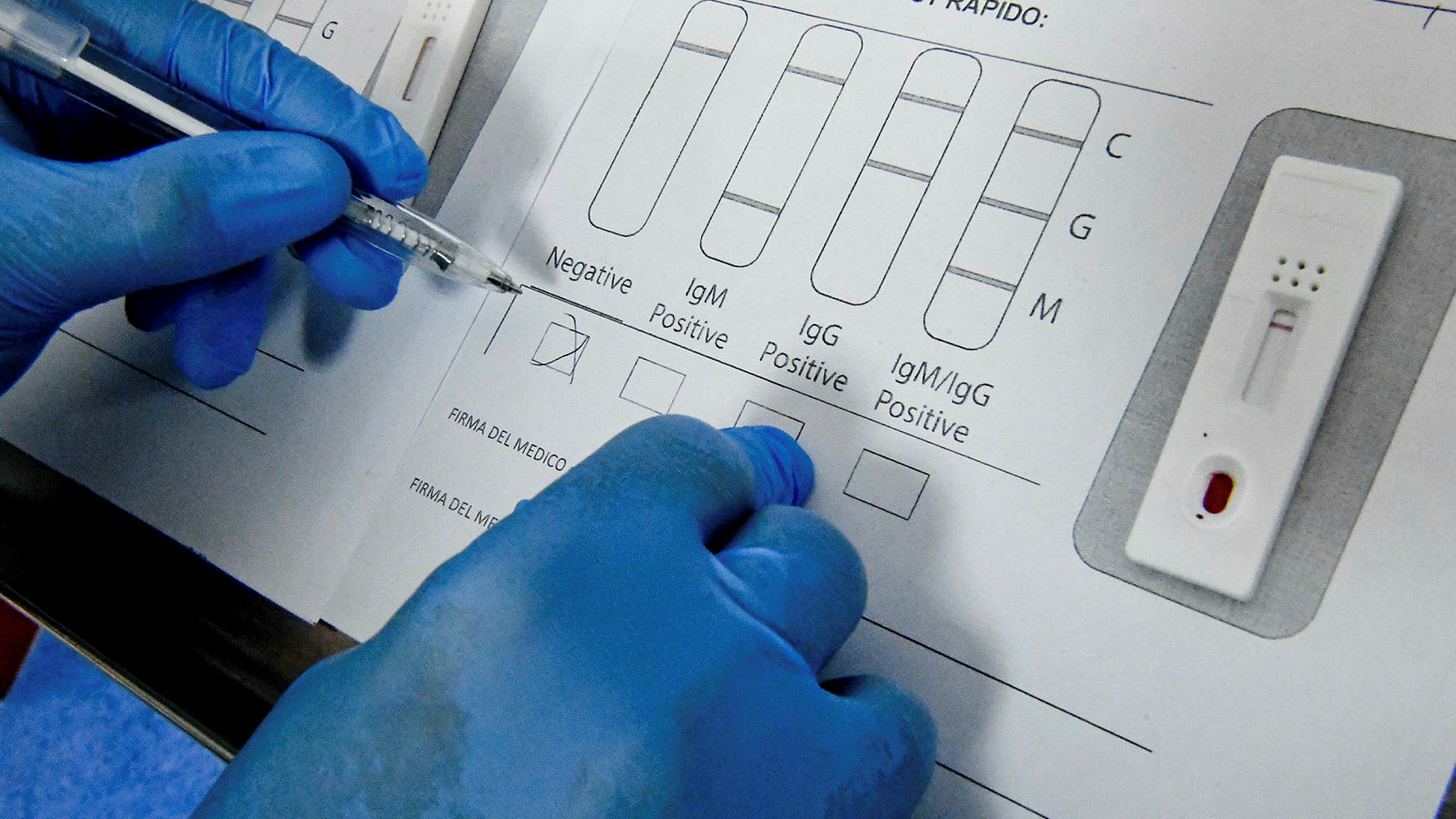 39 Popular Is the covid antibody test free Trend in This Years