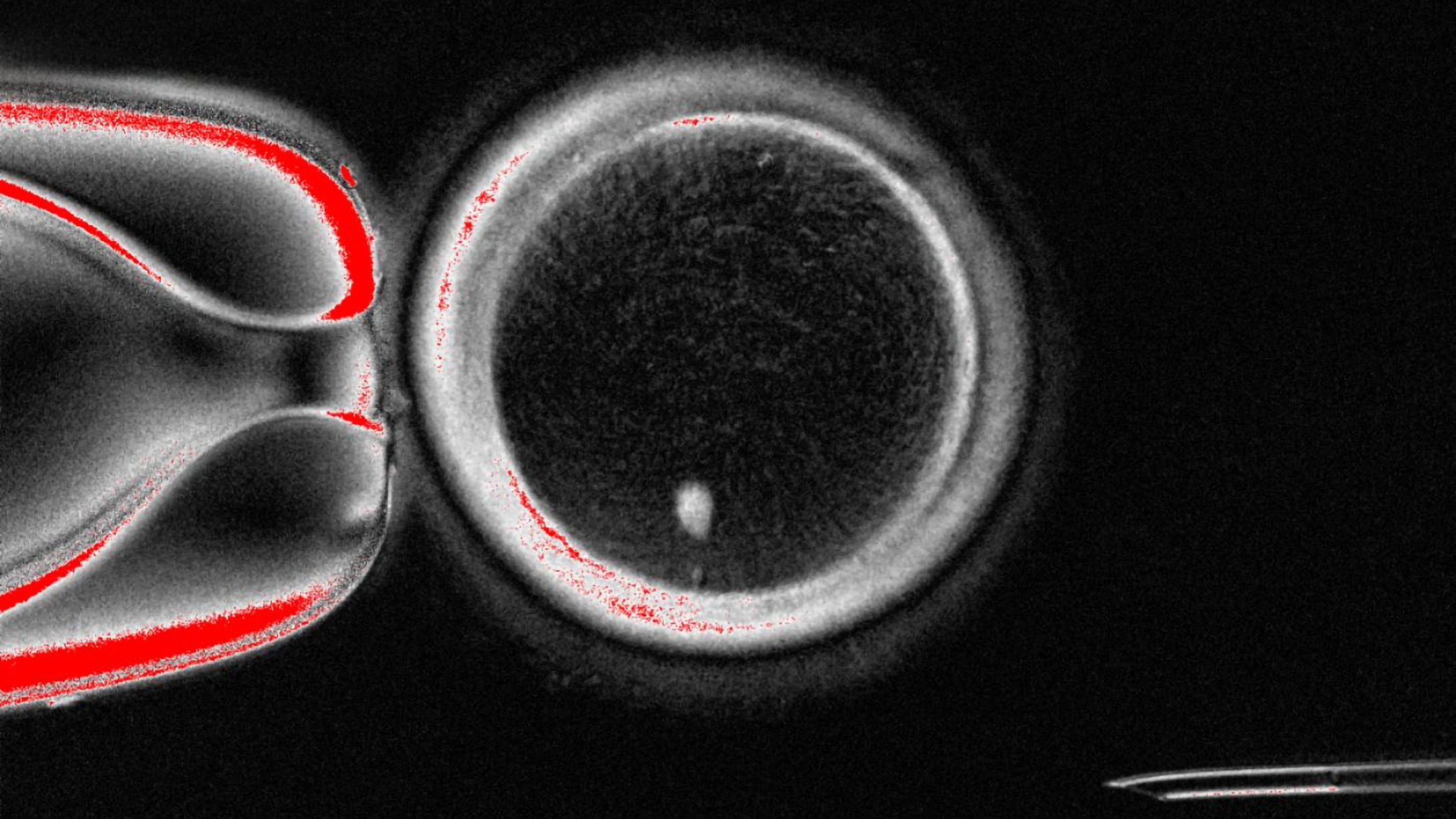 Scientists use cloning technology to swap DNA in human eggs