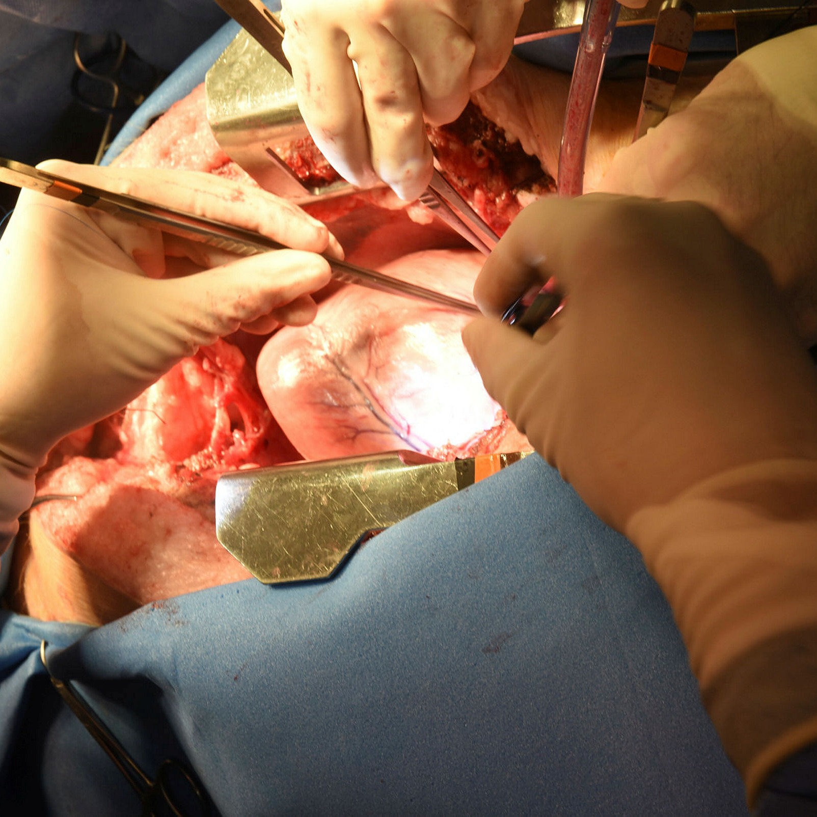 A surgeon operates on a pig prior to the removal of its heart